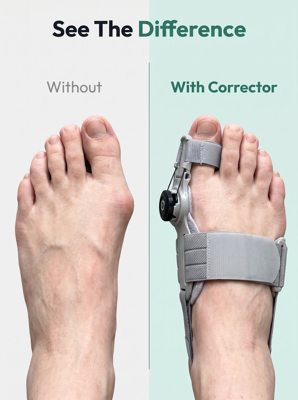 Lorea Bunion Corrector